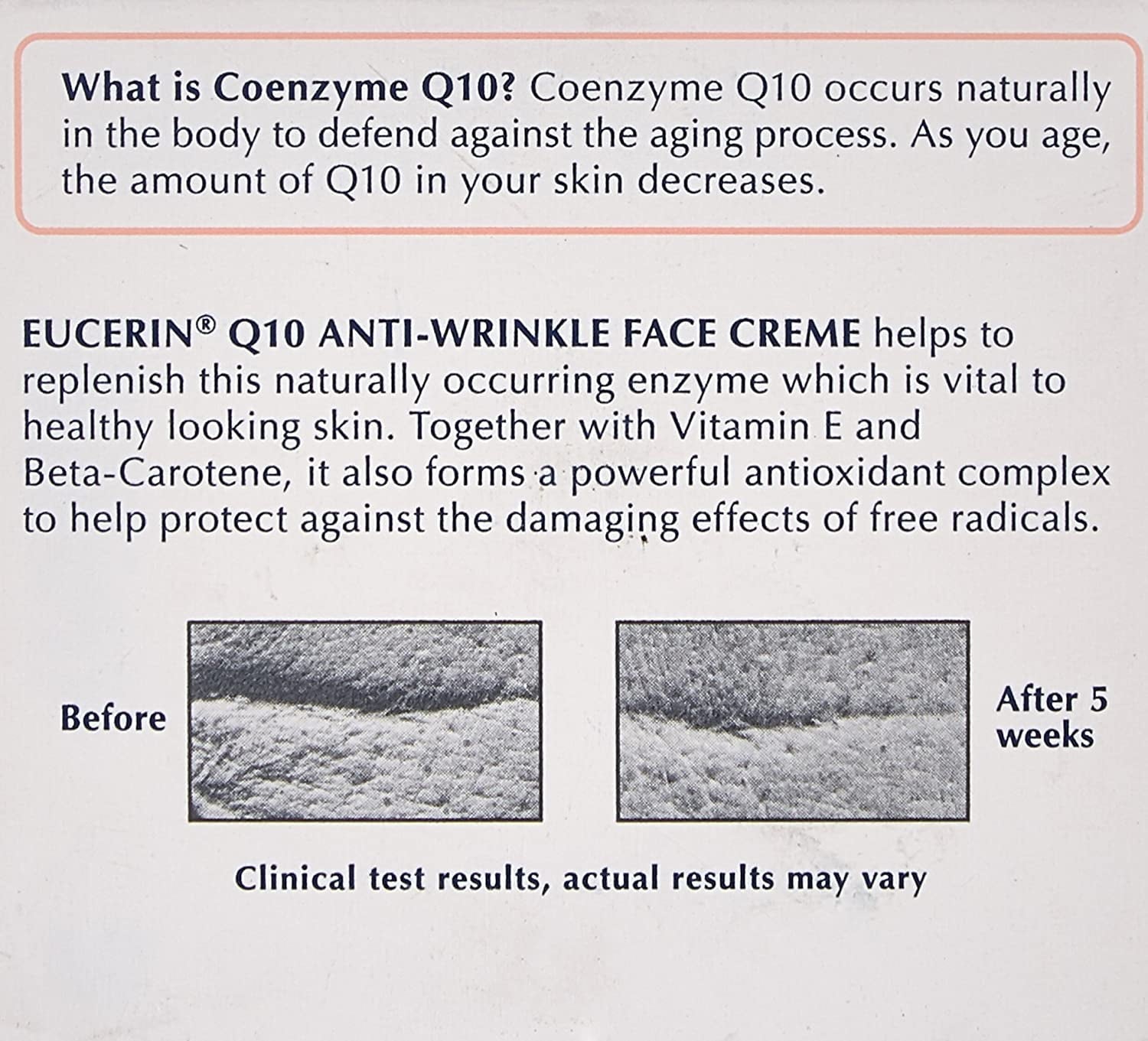 Eucerin Sensitive Skin Experts Q10 Anti-Wrinkle Face Creme 1.70 oz