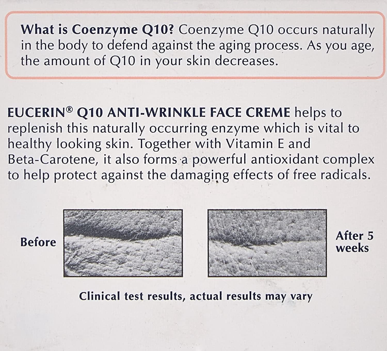 Eucerin Sensitive Skin Experts Q10 Anti-Wrinkle Face Creme 1.70 oz